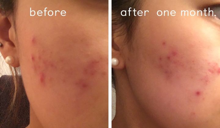 A'PIEU Glycolic acid cream