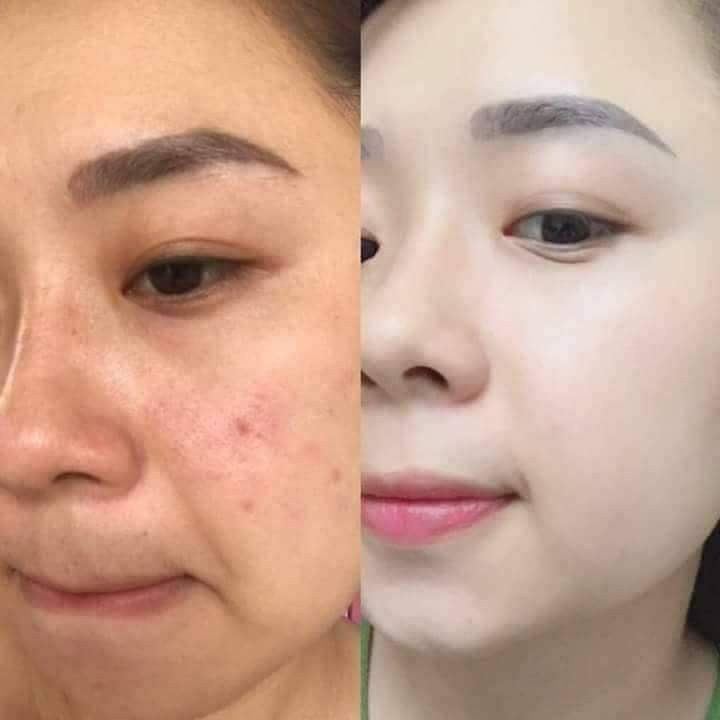 Haruharu miracle black rice hyalurnic toner