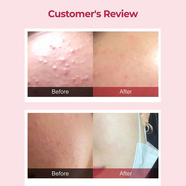 Cosrx salicylic acid daily gentle cleanser