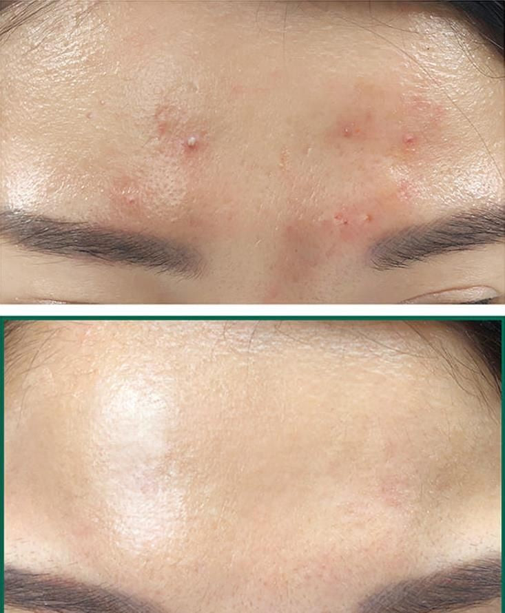 A'PIEU Glycolic acid cream