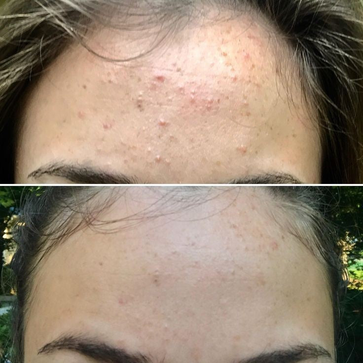 A'PIEU Glycolic acid cream