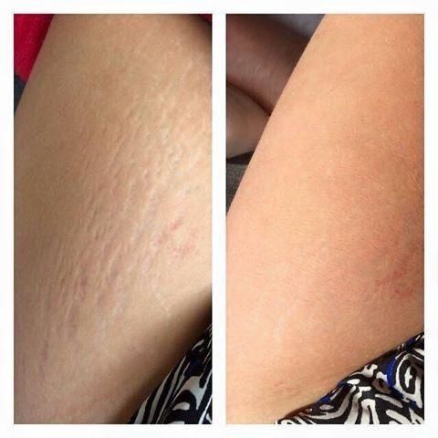body butter for Streingmarkt