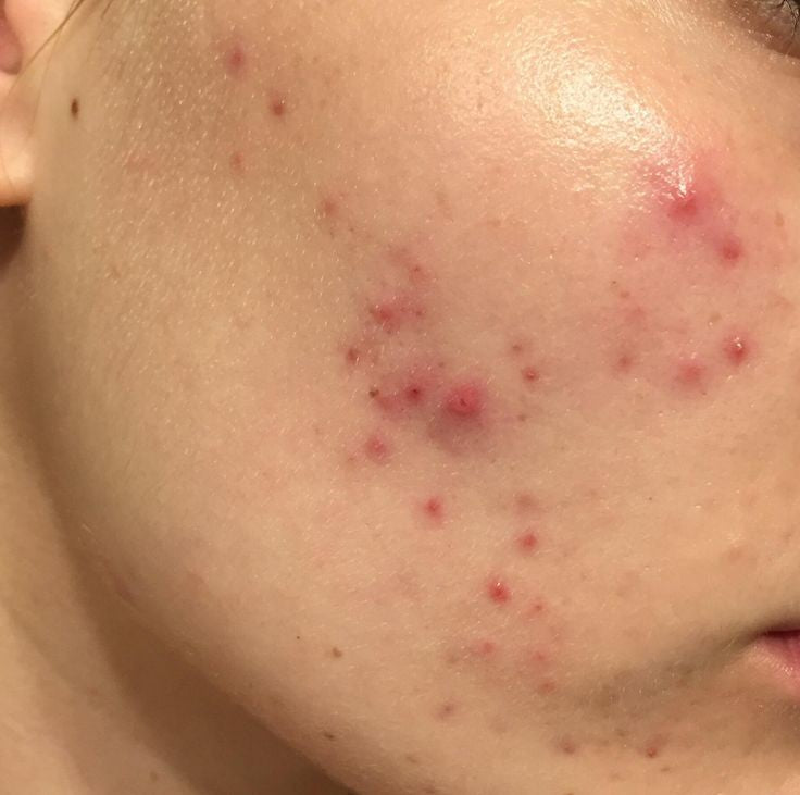 A'PIEU Glycolic acid cream