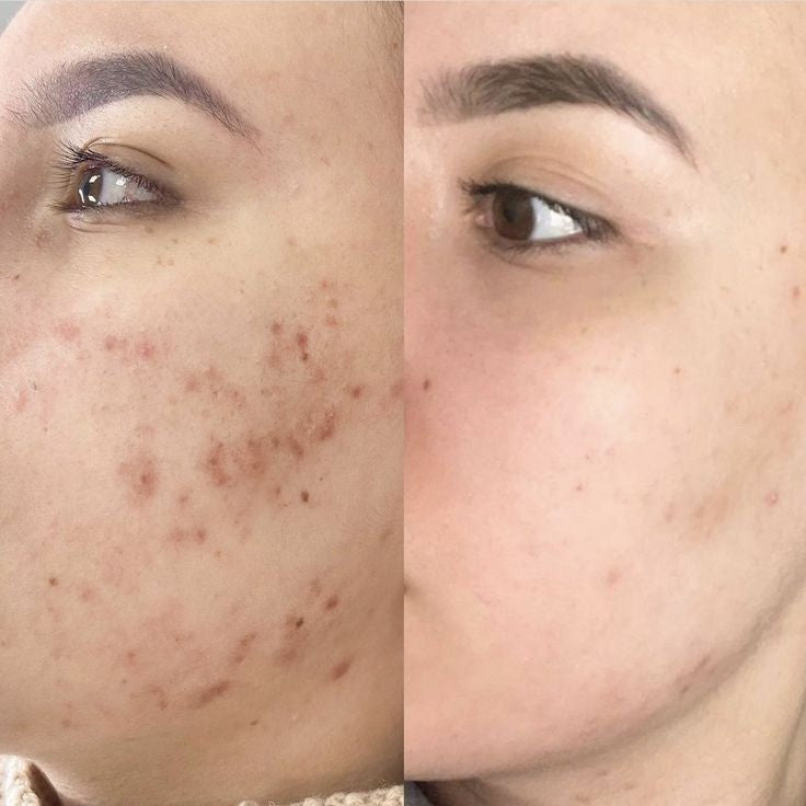 A'PIEU Glycolic acid cream