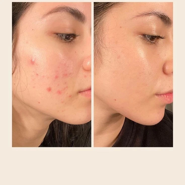 Cosrx salicylic acid daily gentle cleanser