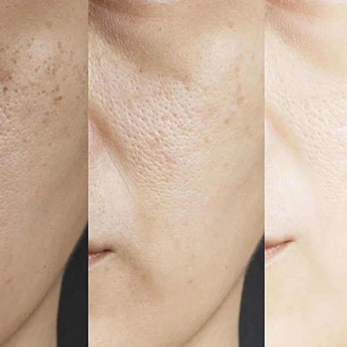 Carenel niacinamid 10%&zink1%