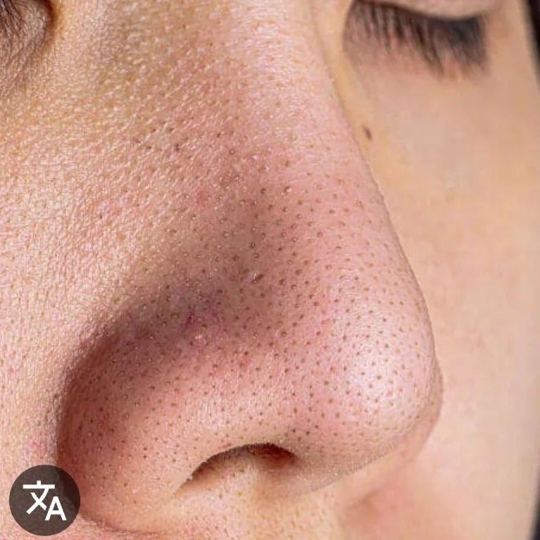 Carenel niacinamid 10%&zink1%