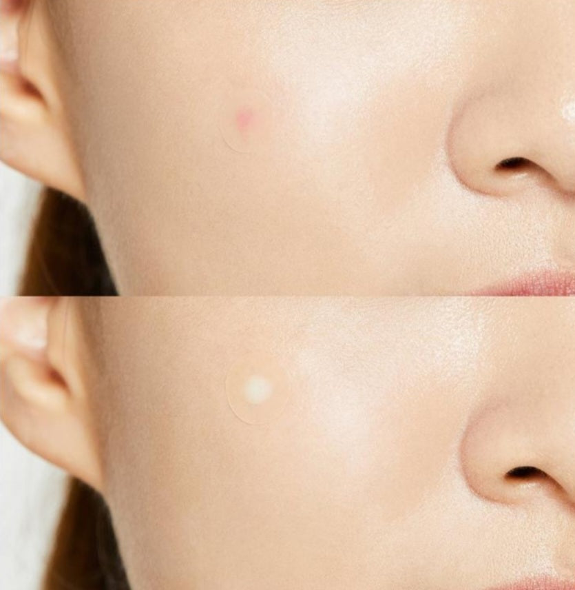 Cosrx acne pimples Master patch⚫️ لصقات الحبوب الفجائية وتغطية حبوب المناسبات وتقليل حجمها