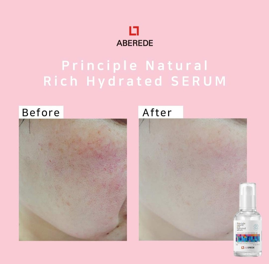 Aberede rich hydrated serum