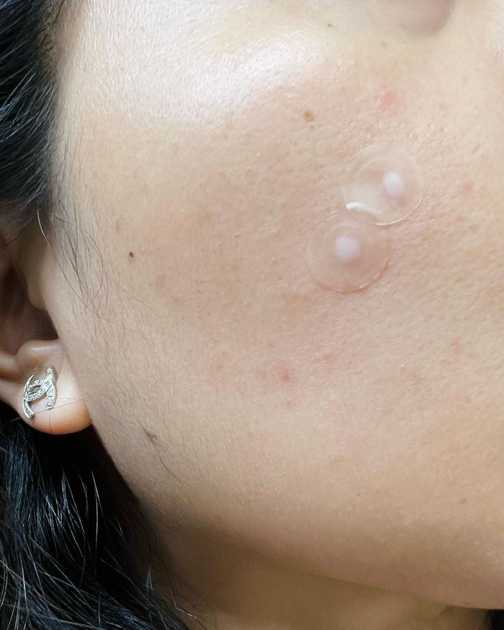Cosrx acne pimples Master patch⚫️ لصقات الحبوب الفجائية وتغطية حبوب المناسبات وتقليل حجمها