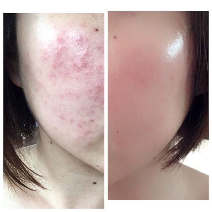 A'PIEU Glycolic acid cream