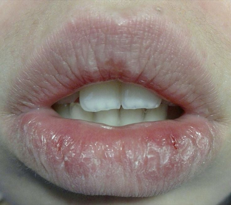 Lippen pflege set