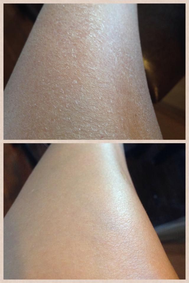 Bioaqua fruit acid scrub๐๐ ู
ูุดุฑ ุงูุฃุญู
ุงุถ ุงูููู
ูุงุฆู ููุฌูุฏ ุงูู
ูุช๐๐