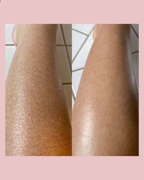 Bioaqua fruit acid scrub๐๐ ู
ูุดุฑ ุงูุฃุญู
ุงุถ ุงูููู
ูุงุฆู ููุฌูุฏ ุงูู
ูุช๐๐